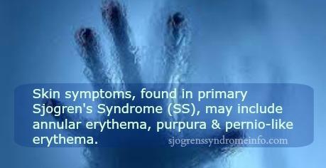 skin symptoms in sjogrens syndrome