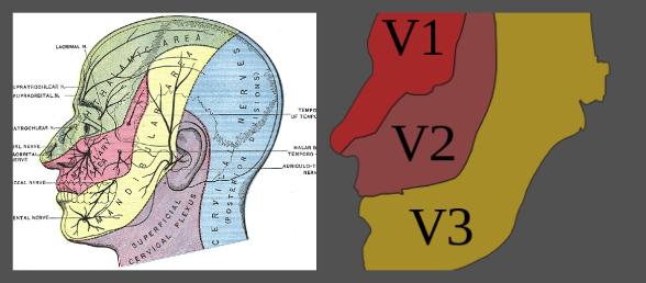 Trigeminal neuralgia diagrams